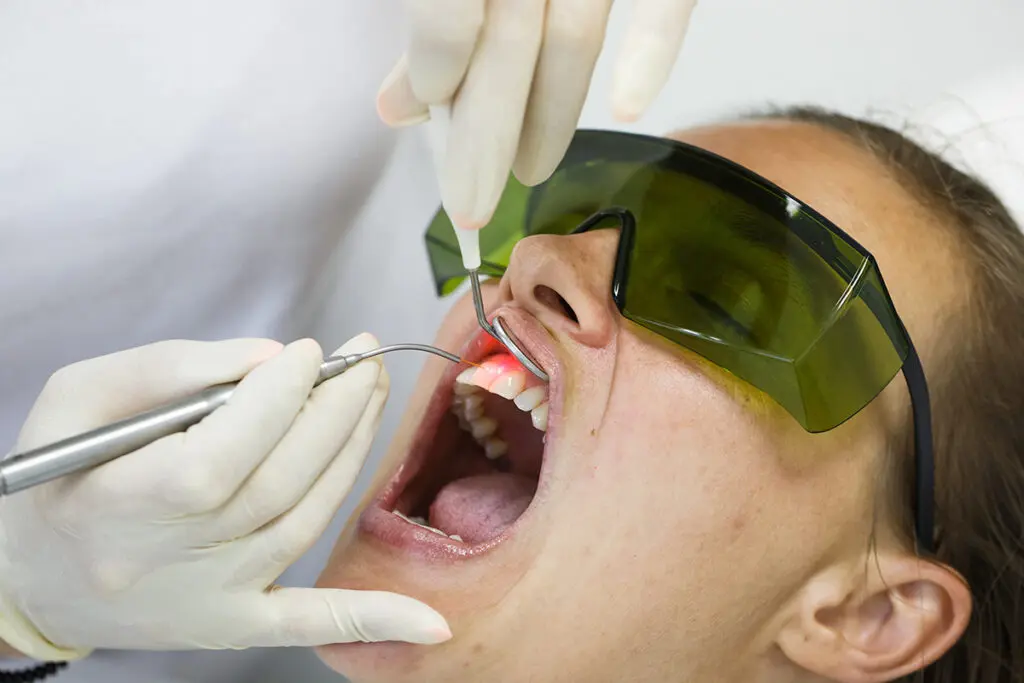 Peri-Implantitis Treatment with LANAP Laser Therapy