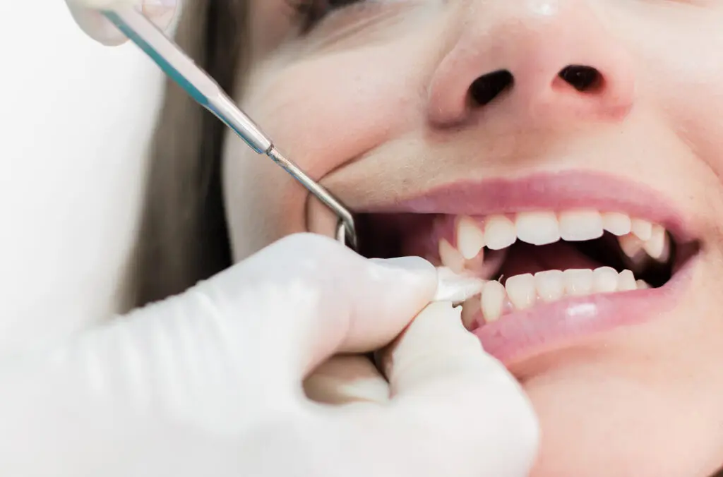 How Long to Keep Gauze in After Tooth Extraction: Recovery Tips