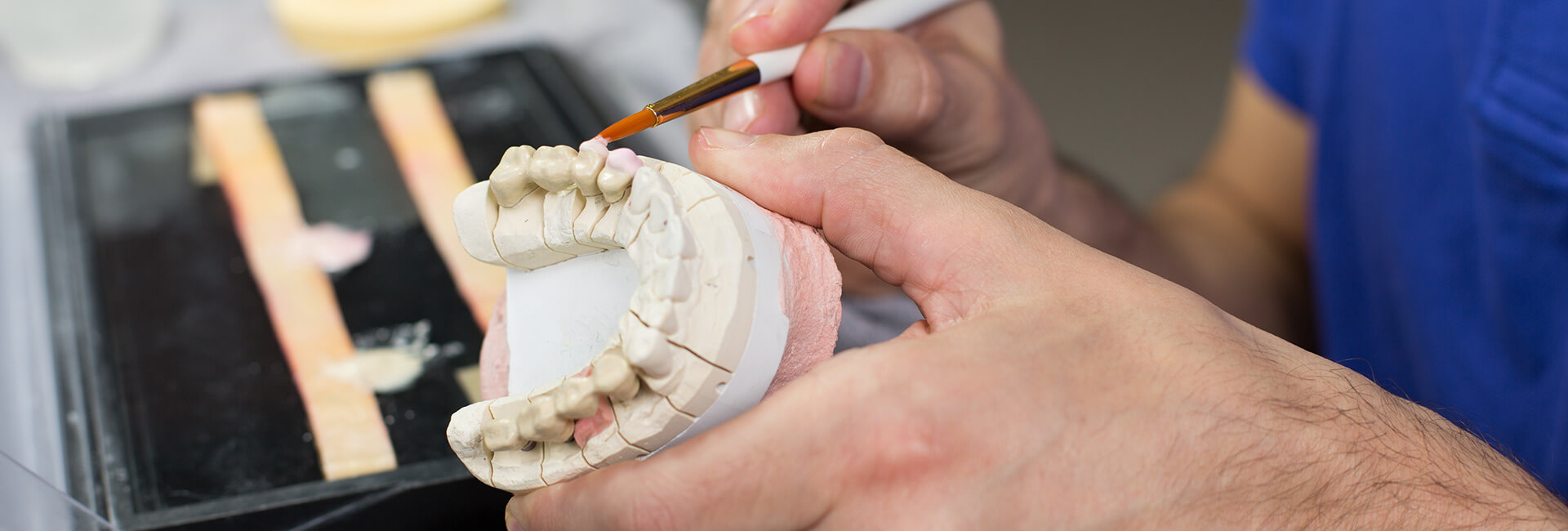 Prosthodontics - Argyle Family Dental